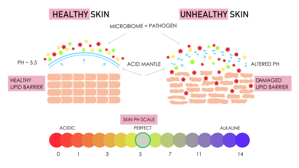 Healthy v Unhealthy Skin illustration
